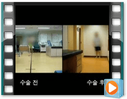 (수술전/후) 보행 1