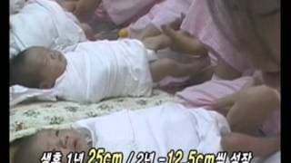 생로병사의 비밀