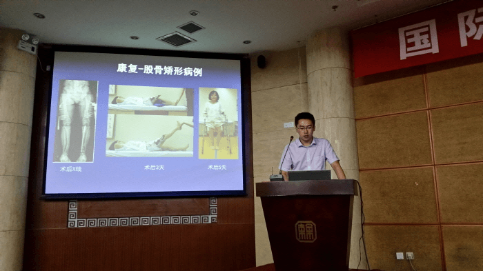 제2회 국제정형외과학포럼(중국)