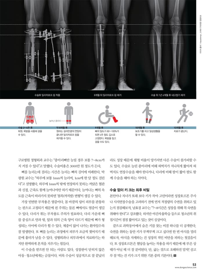 수술 후 회복 과정 - 인포그래픽 6