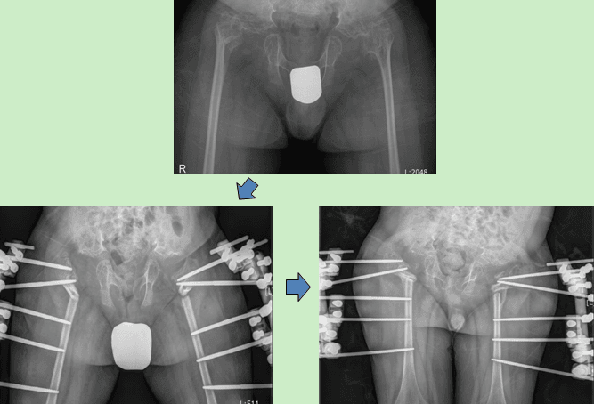 surgery-deformity-14001657-img2.png