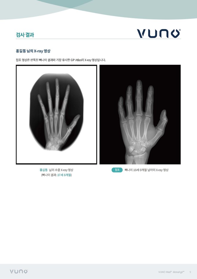 소아종합검진 상세 6